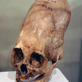 mysterious peruvian skull.png